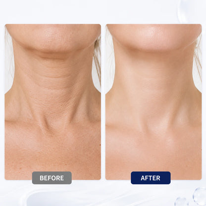 Collagen Neck Cream – Hydrating Daily Care